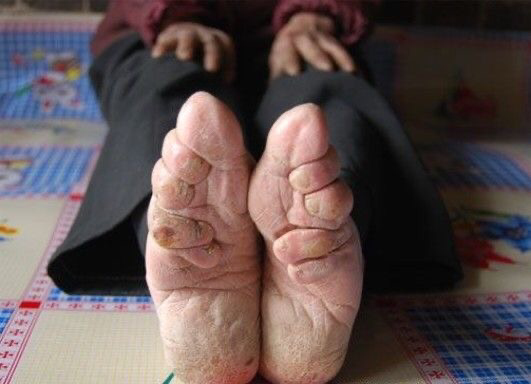 Lotus feet, Kaki Cantik Budaya China