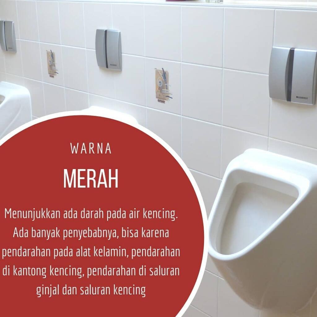 Apa Warna Urine Anda Hari Ini?