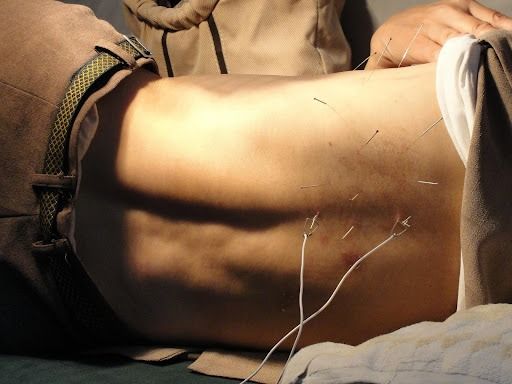 Titik Akupuntur Asam Lambung Agar Tidak Kambuh
