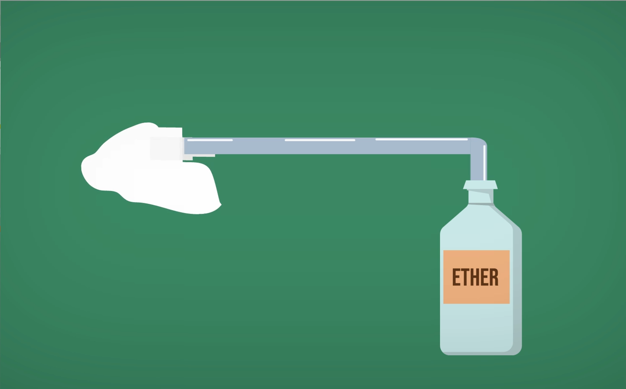 Bagaimana Jadinya Kalau Obat Bius Tidak Ditemukan?