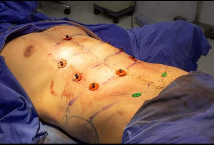Pharap Perut Six Pack? Begini Cara Mendapatkan Secara Cepat!