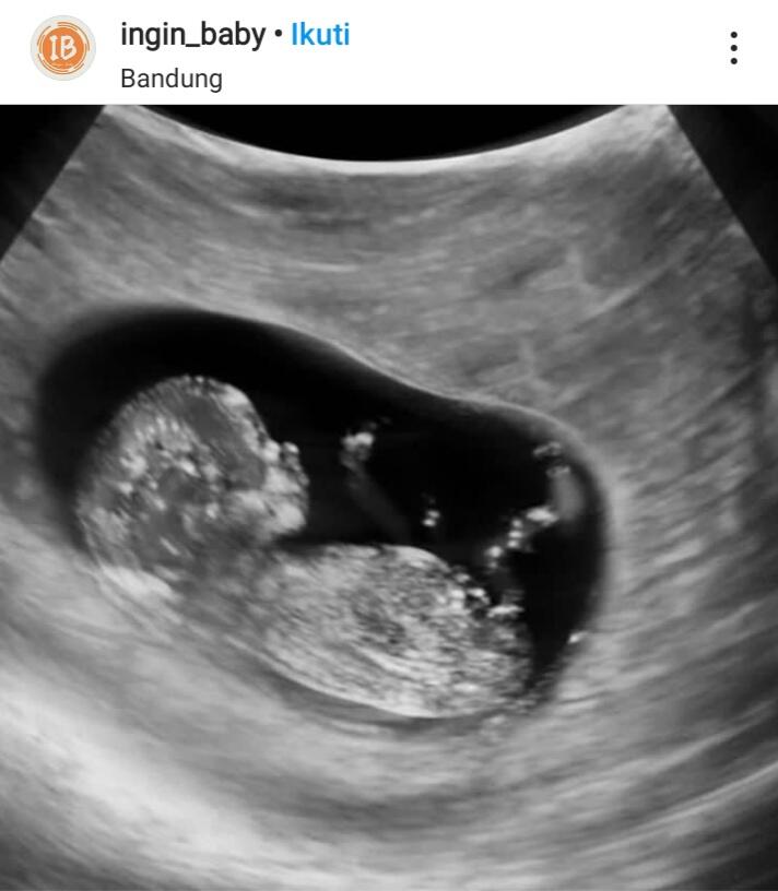 Beratnya Seorang Wanita Hamil, Benarkah Demikian?
