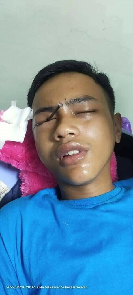 Makassar Darurat BUSUR (Panah Ketapel)