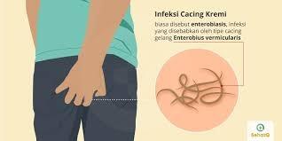 Bukan Belatung, Tapi Cacing Kremi Yang Bisa Berada Di Vagina!