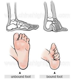 Lotus feet, Kaki Cantik Budaya China