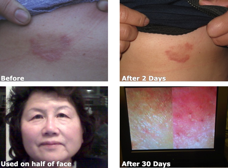 luminescebeforeafter6.jpg