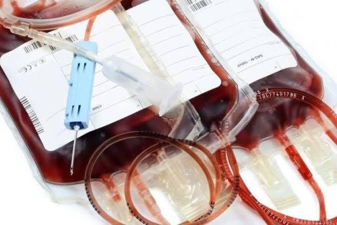7 Harga Organ Tubuh Manusia Termahal 