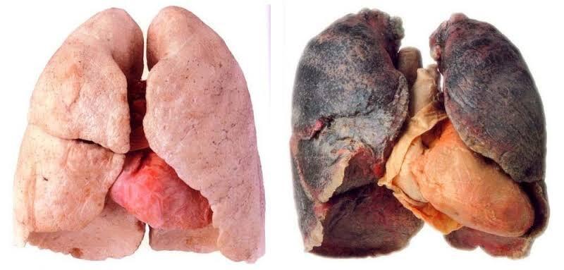 7 Harga Organ Tubuh Manusia Termahal 