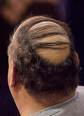 bald-hairstyle-bad-11.jpg