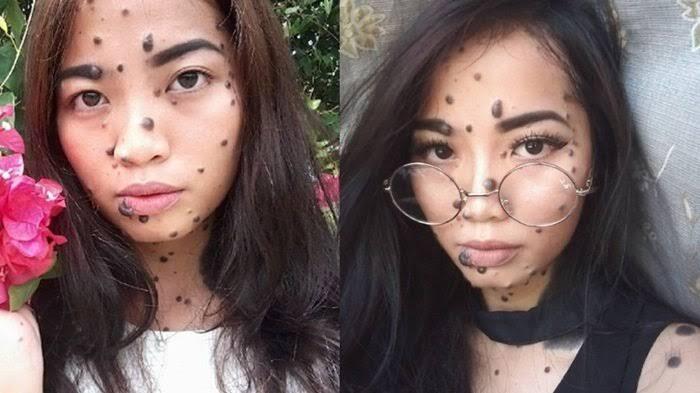 Bintik Di Wajah Kok Disebut Tahi Lalat? 
