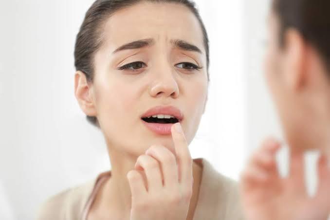 Cara Jitu Atasi Bibir Kering Saat Berpuasa