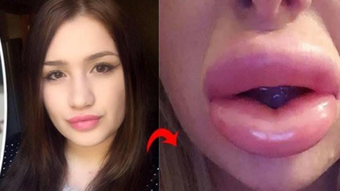 Mau Terlihat Seksi Tapi Gagal? Ini Contohnya