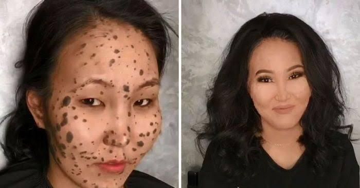 Bintik Di Wajah Kok Disebut Tahi Lalat? 