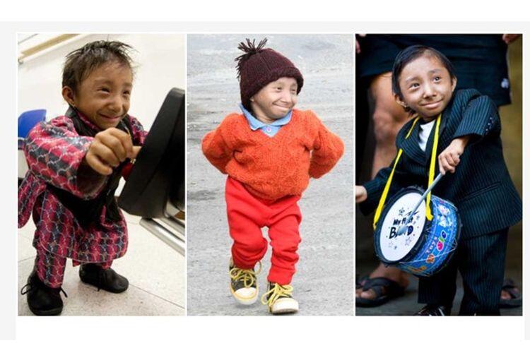 10 ORANG PALING KECIL DI DUNIA