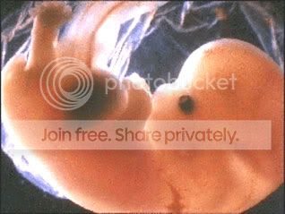 abort.jpg