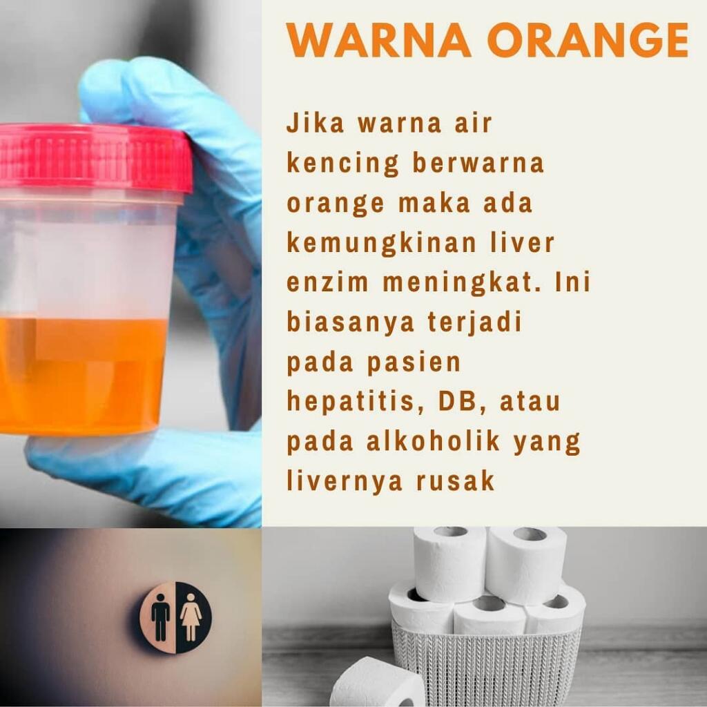 Apa Warna Urine Anda Hari Ini?