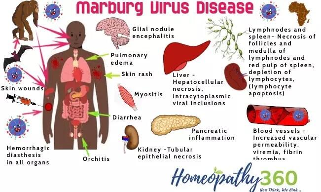 Virus Mematikan Marburg Merebak di Afrika