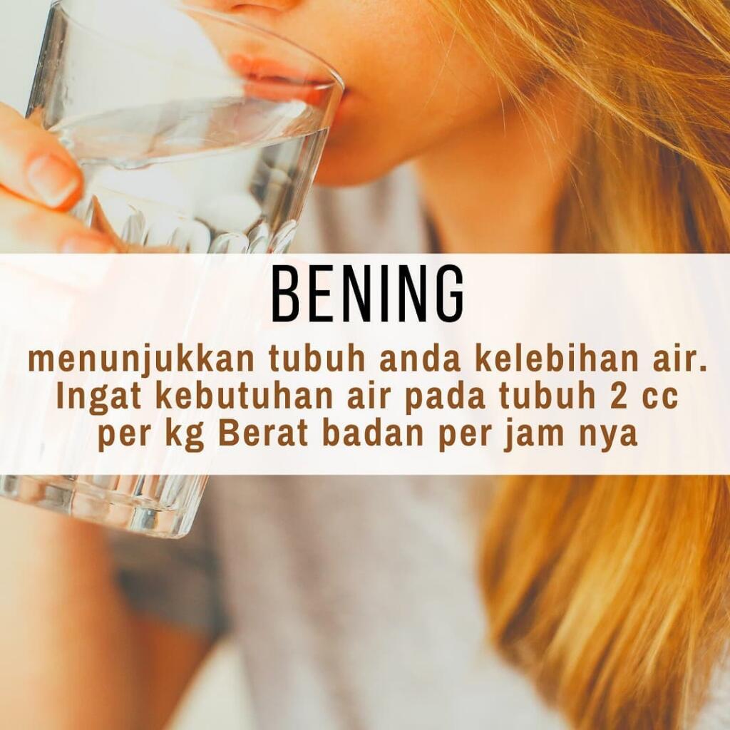 Apa Warna Urine Anda Hari Ini?