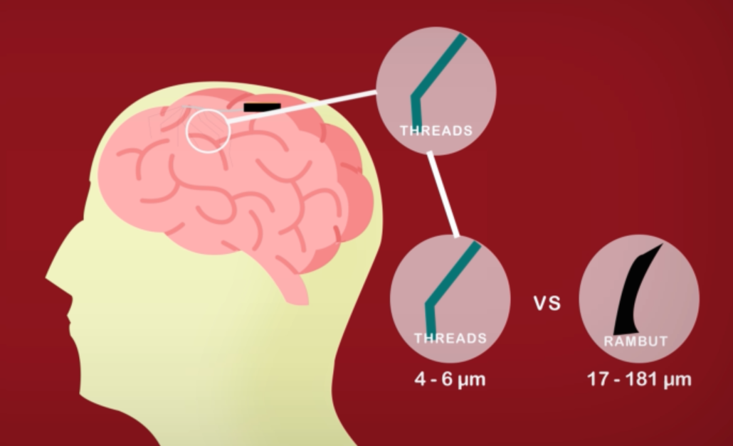 Apa itu Neuralink & Bagaimana Cara Kerjanya ?