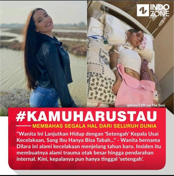 Cantik, Tapi Kepala Kok Hilang Sebagian?!