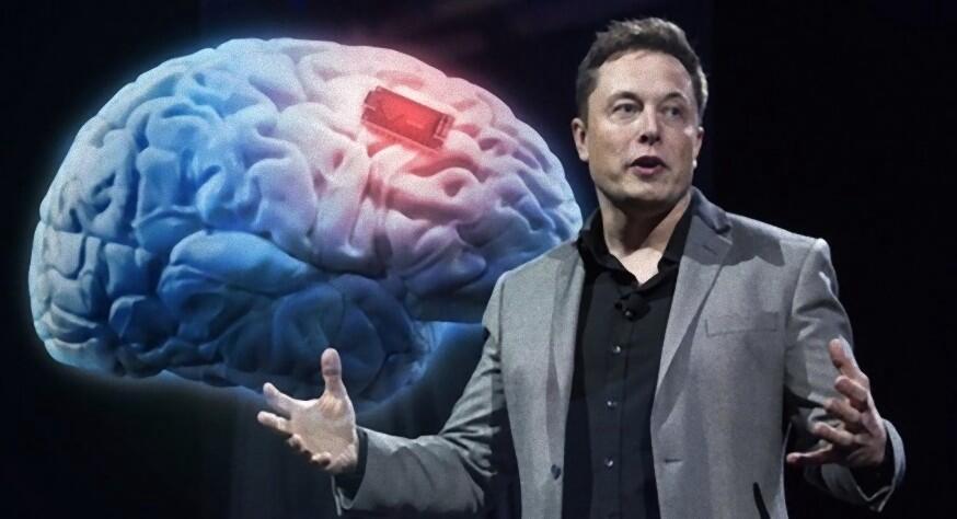 Apa itu Neuralink & Bagaimana Cara Kerjanya ?