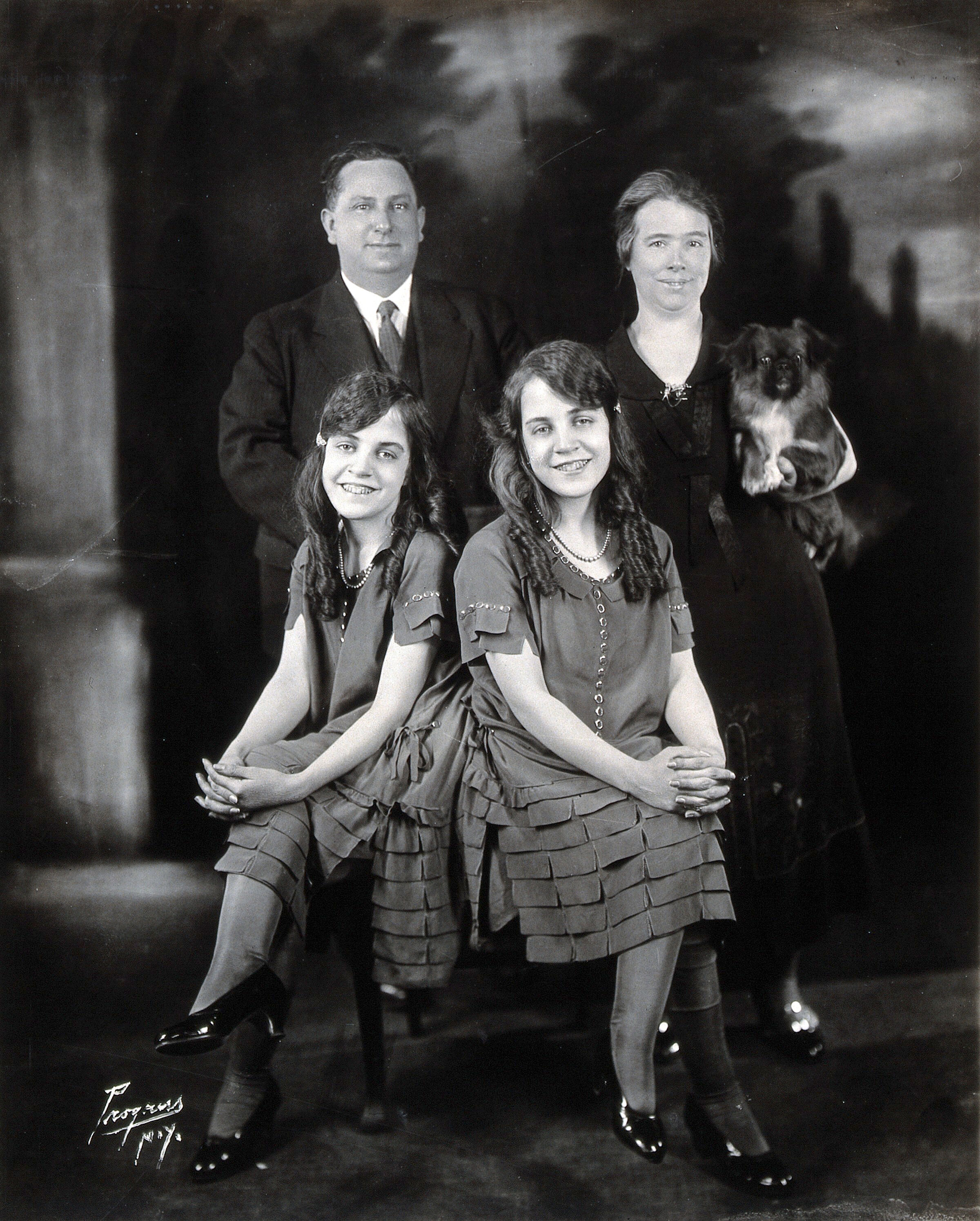 Memilukan, Kisah Saudara Kembar Daisy & Violet Hilton