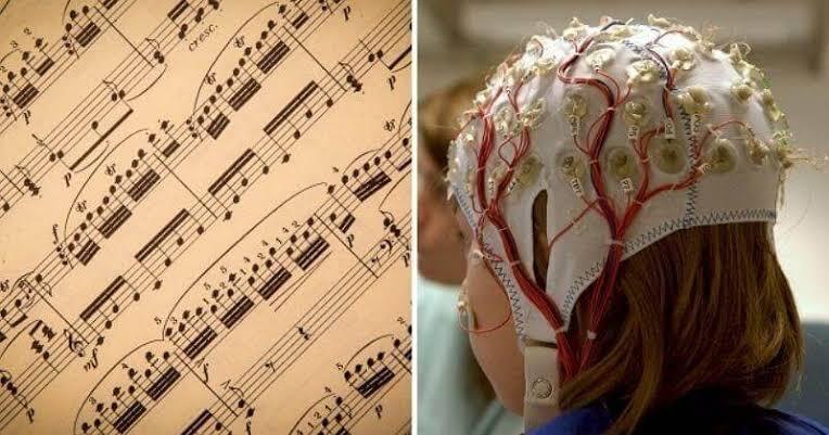 Musik Mozart Dapat Menyembuhkan Epilepsi