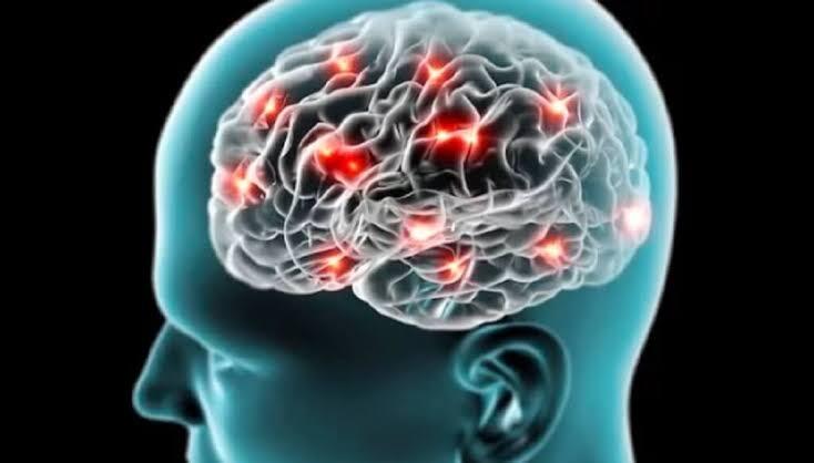 Bagaimana Epilepsi, Bisa Terjadi?