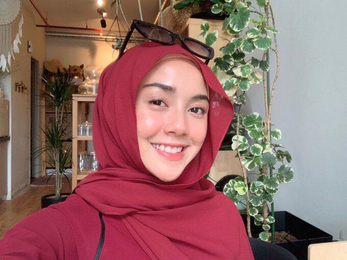 Dikatai Muka Sampah, Transformasi Wanita Ini Membuat Netizen Melongo!