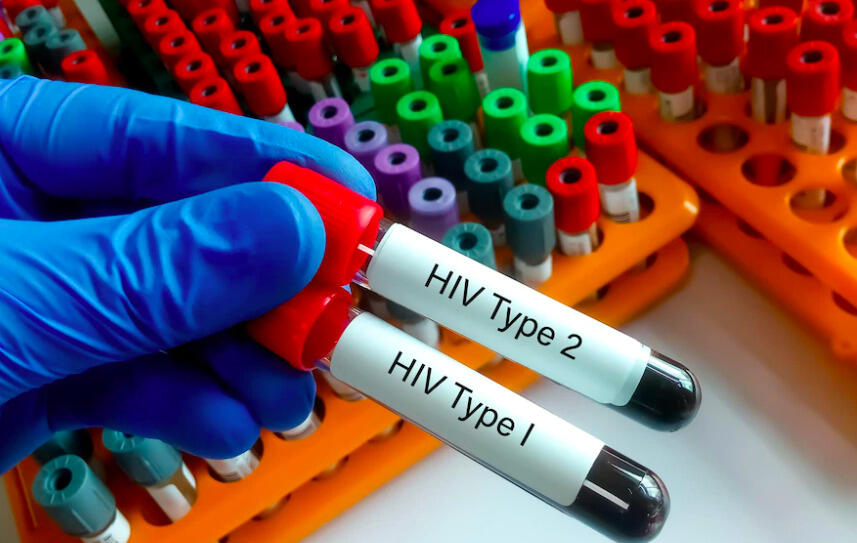 Lebih Bahaya, ODHIV Aids Sempat Terlupakan Karna Covid 19