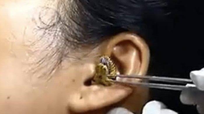 Ular Masuk Dalam Kuping, Duh Ngeri Gan!