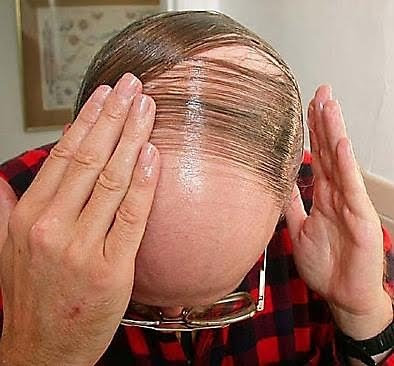 bald-hairstyle-bad-12.jpg