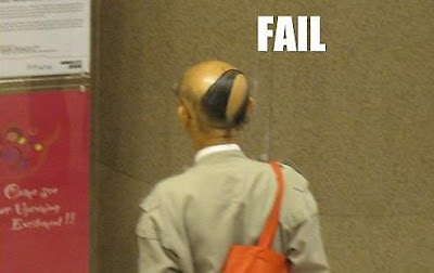 bald-hairstyle-bad-14.jpg