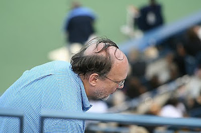 bald-hairstyle-bad-27.jpg